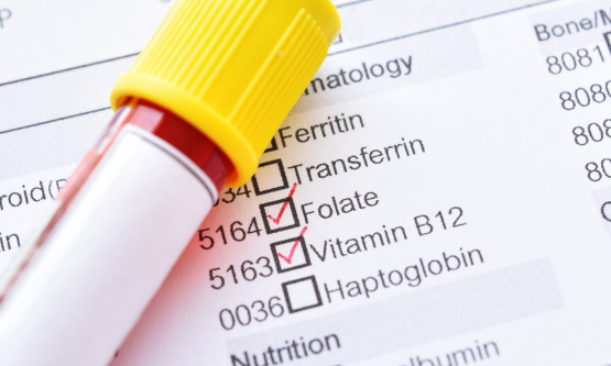 Folaat of foliumzuur? Dit is de beste optie